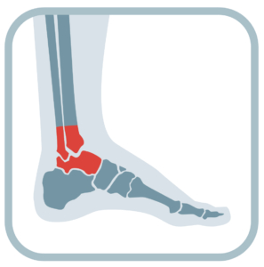 Ankle Joint Pain Relief