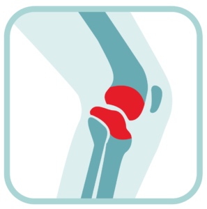 Knee Joint Treatment Relief