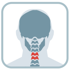 Healing Neck Pain Treatment